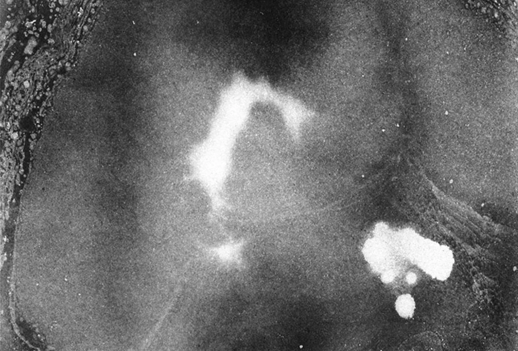 Grainy black-and-white image with bright organic shapes